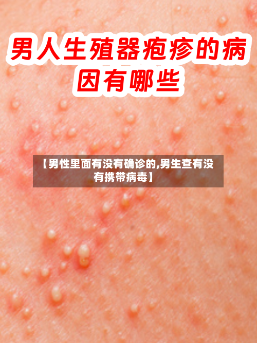 【男性里面有没有确诊的,男生查有没有携带病毒】