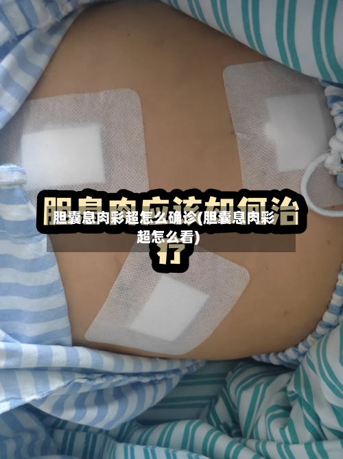 胆囊息肉彩超怎么确诊(胆囊息肉彩超怎么看)-第2张图片
