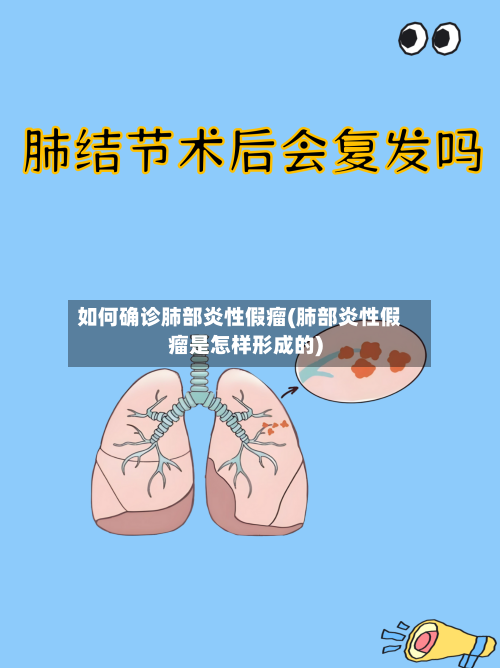 如何确诊肺部炎性假瘤(肺部炎性假瘤是怎样形成的)-第2张图片