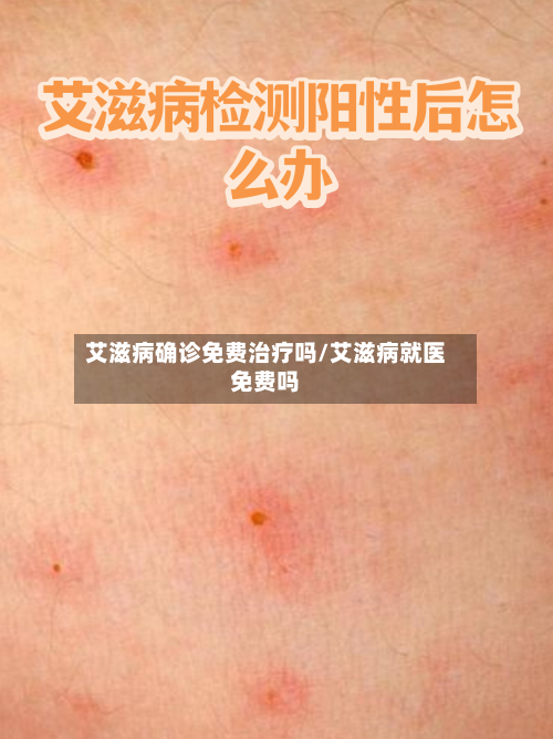 艾滋病确诊免费治疗吗/艾滋病就医免费吗