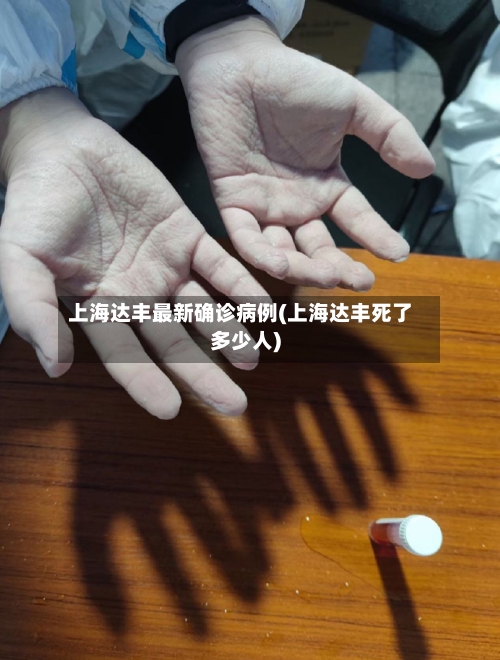 上海达丰最新确诊病例(上海达丰死了多少人)