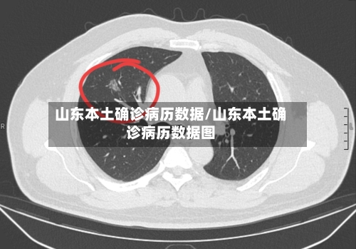 山东本土确诊病历数据/山东本土确诊病历数据图-第3张图片
