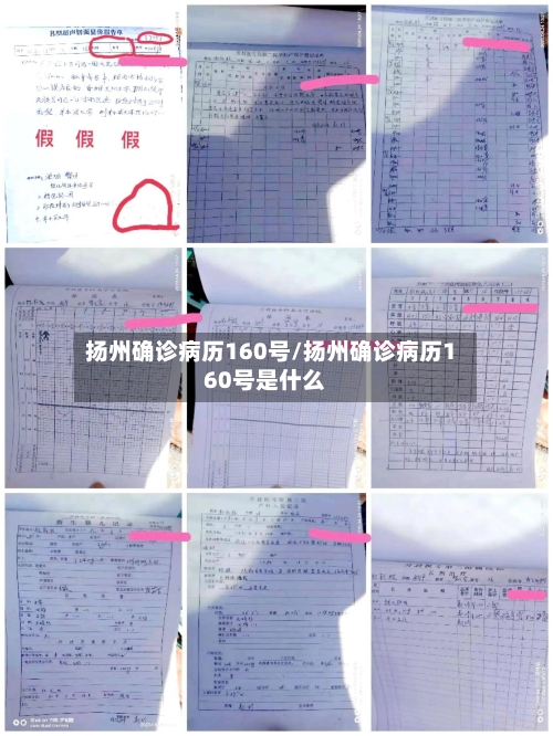 扬州确诊病历160号/扬州确诊病历160号是什么
