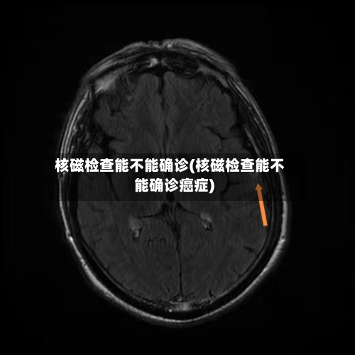 核磁检查能不能确诊(核磁检查能不能确诊癌症)-第2张图片