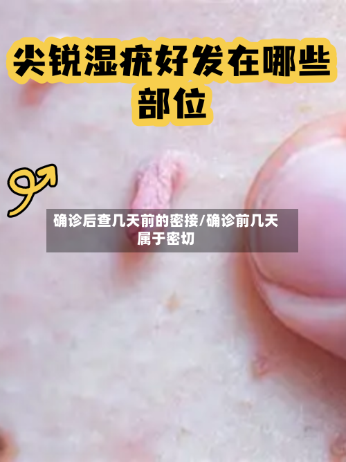 确诊后查几天前的密接/确诊前几天属于密切-第2张图片