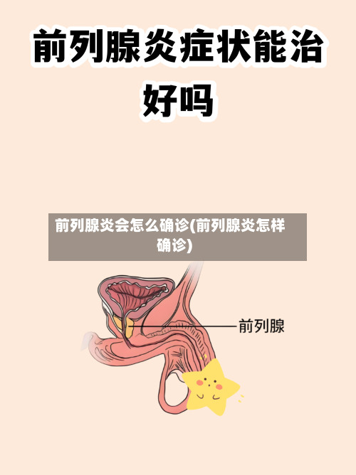前列腺炎会怎么确诊(前列腺炎怎样确诊)