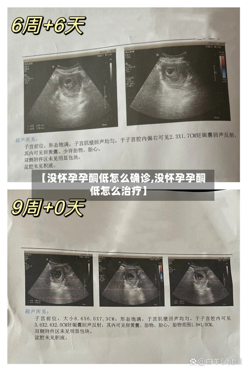 【没怀孕孕酮低怎么确诊,没怀孕孕酮低怎么治疗】-第3张图片