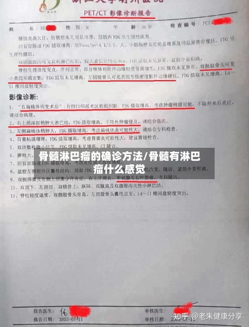 骨髓淋巴瘤的确诊方法/骨髓有淋巴瘤什么感觉-第2张图片