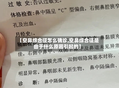 【空鼻综合征怎么确诊,空鼻综合征是由于什么原因引起的】-第2张图片