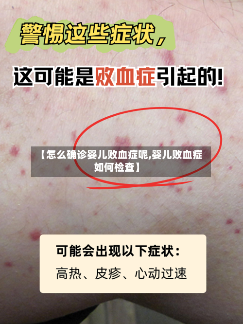 【怎么确诊婴儿败血症呢,婴儿败血症如何检查】