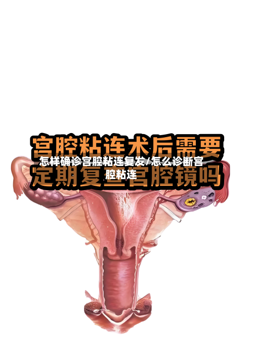 怎样确诊宫腔粘连复发/怎么诊断宫腔粘连