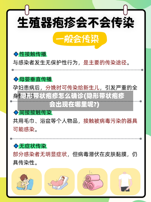 隐形带状疱疹怎么确诊(隐形带状疱疹会出现在哪里呢?)