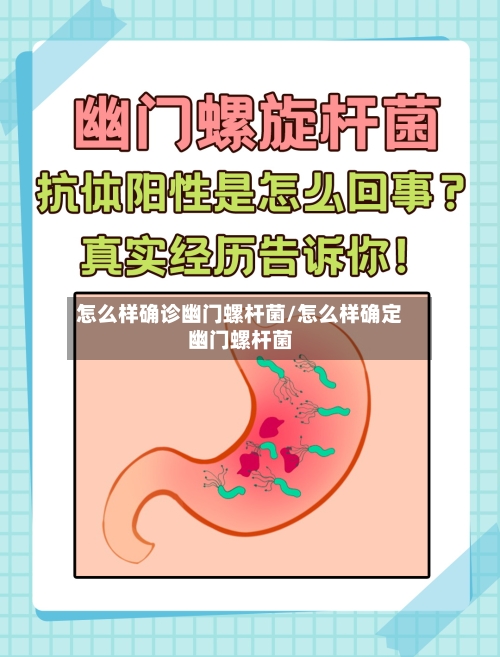 怎么样确诊幽门螺杆菌/怎么样确定幽门螺杆菌