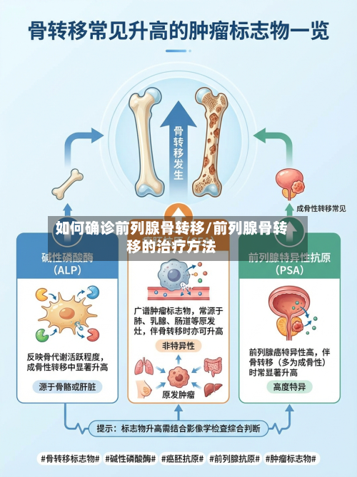 如何确诊前列腺骨转移/前列腺骨转移的治疗方法