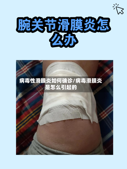 病毒性滑膜炎如何确诊/病毒滑膜炎是怎么引起的