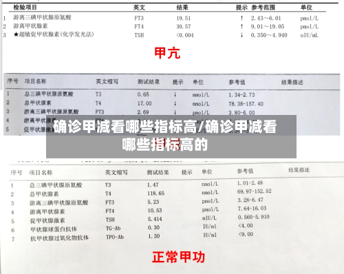 确诊甲减看哪些指标高/确诊甲减看哪些指标高的