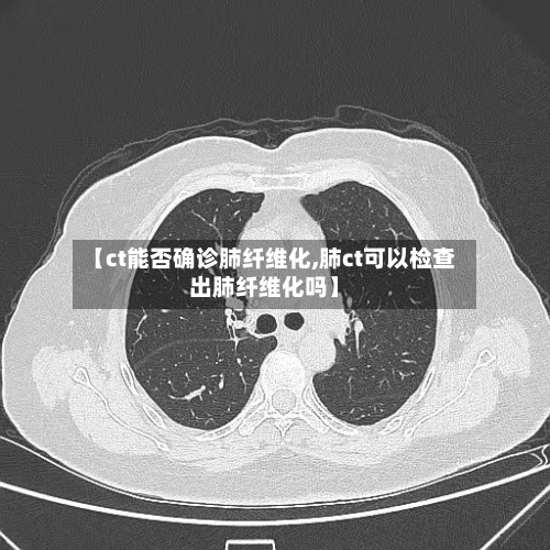 【ct能否确诊肺纤维化,肺ct可以检查出肺纤维化吗】