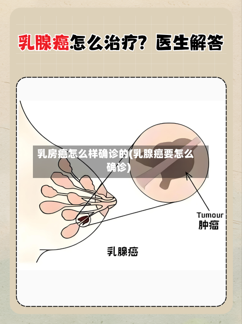 乳房癌怎么样确诊的(乳腺癌要怎么确诊)-第2张图片