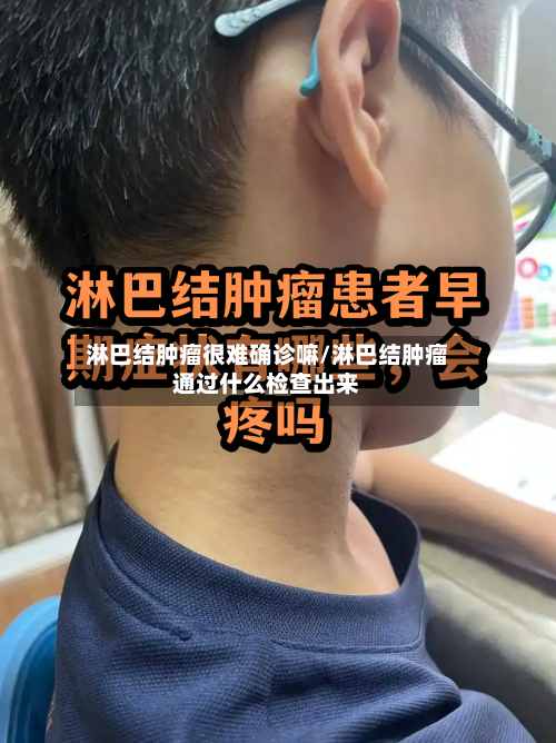 淋巴结肿瘤很难确诊嘛/淋巴结肿瘤通过什么检查出来-第2张图片
