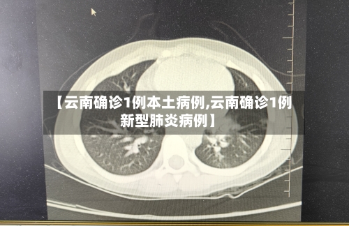 【云南确诊1例本土病例,云南确诊1例新型肺炎病例】