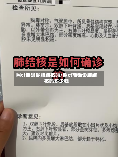 照ct能确诊肺结核吗/照ct能确诊肺结核吗多少钱-第2张图片