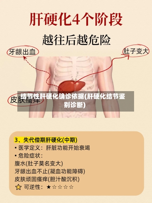 结节性肝硬化确诊依据(肝硬化结节鉴别诊断)-第2张图片