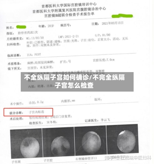 不全纵隔子宫如何确诊/不完全纵隔子宫怎么检查