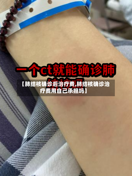 【肺结核确诊后治疗费,肺结核确诊治疗费用自己承担吗】-第2张图片